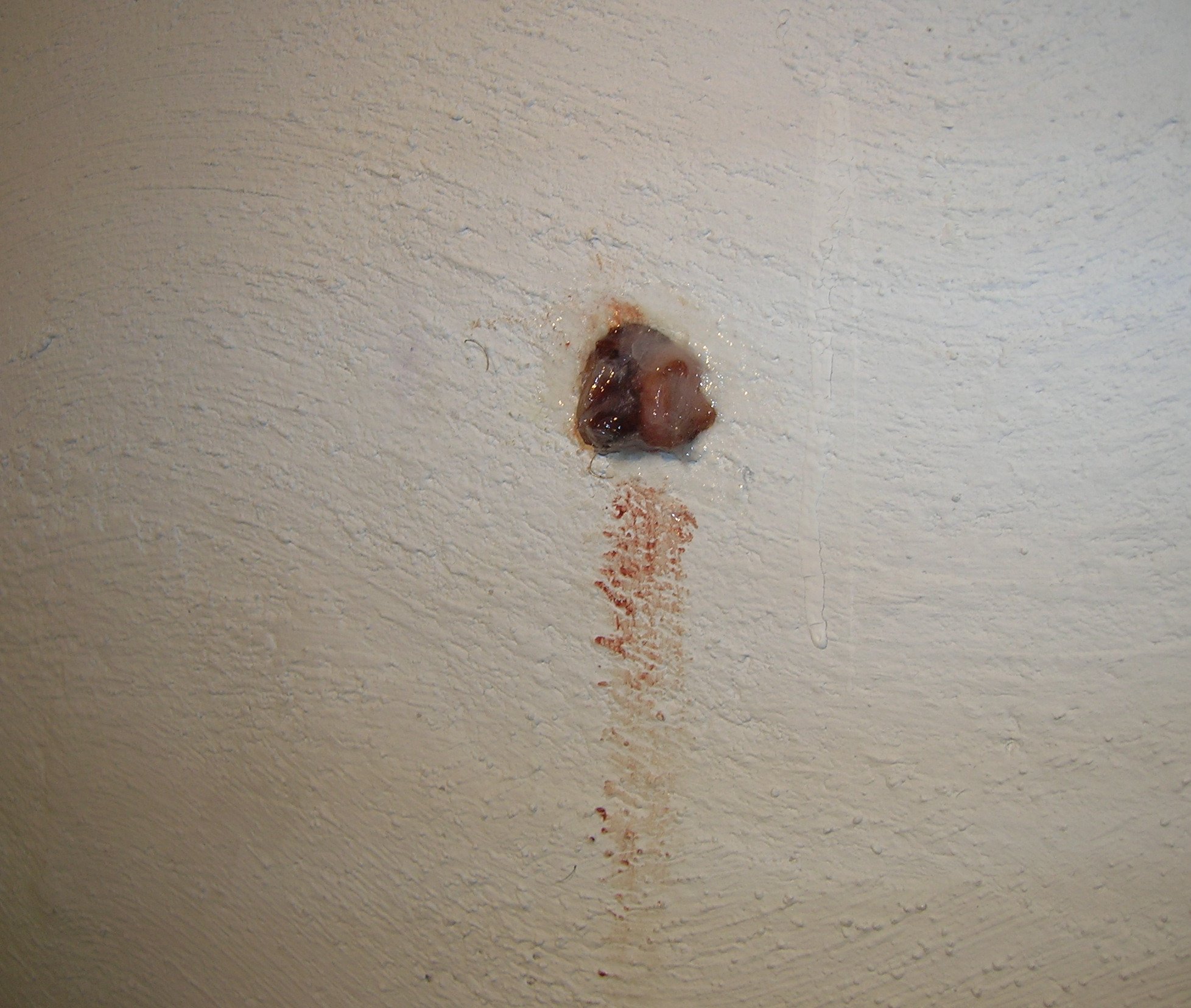 Adrian Parsons' foreskin after art performance